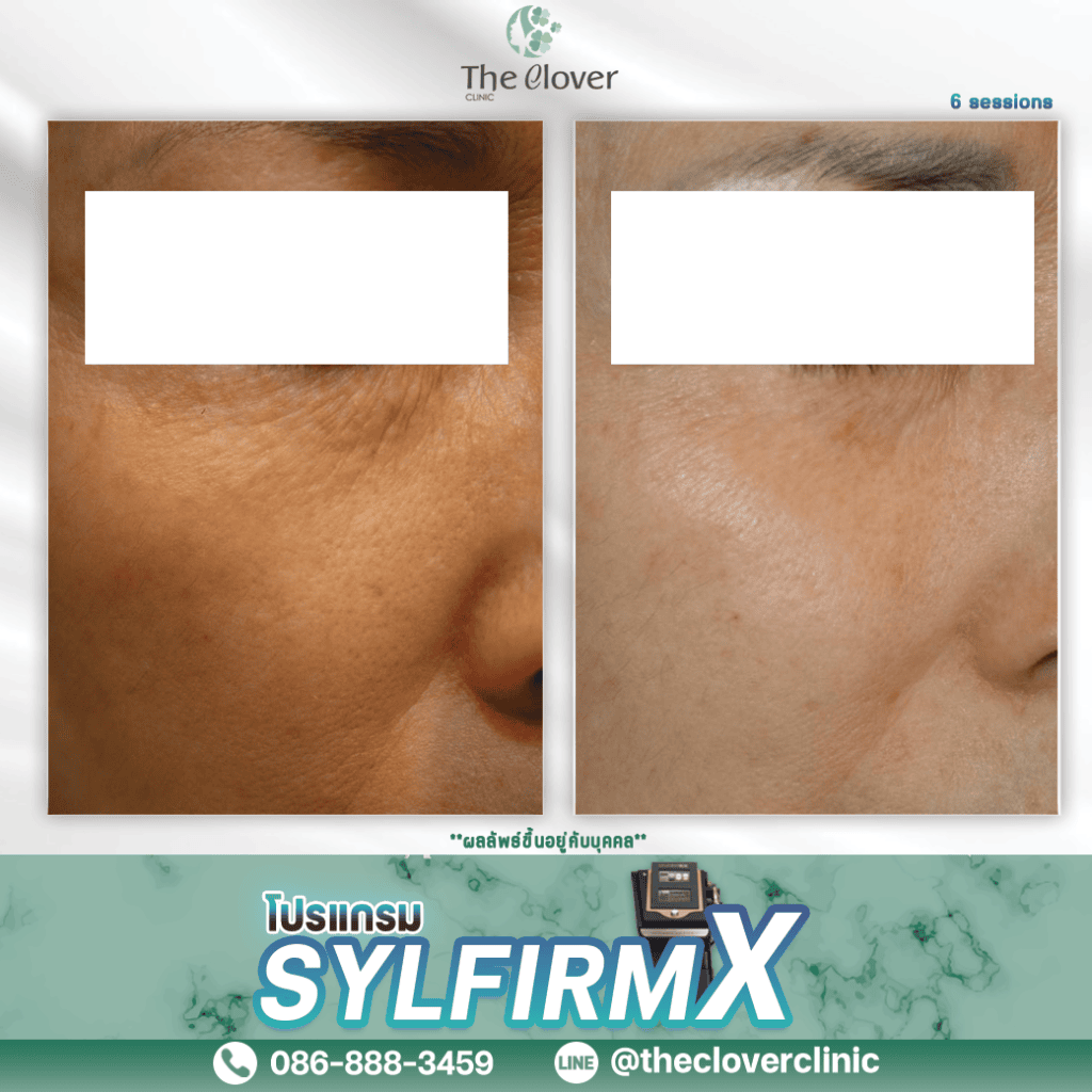 review skyfirm X