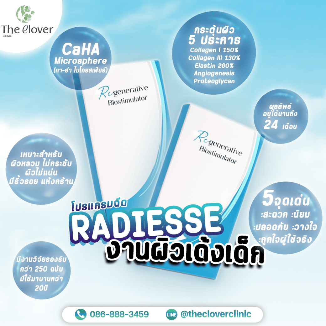 radiesse