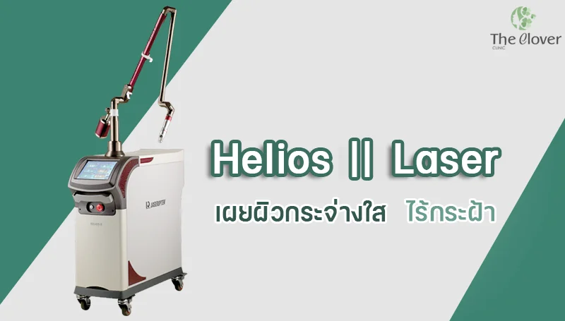 helios II laser