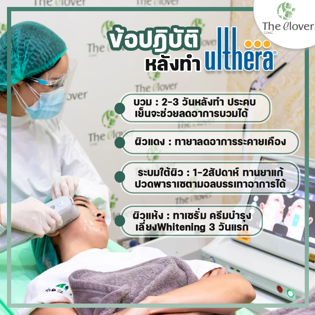 ulthera ดูแลตัวเอง