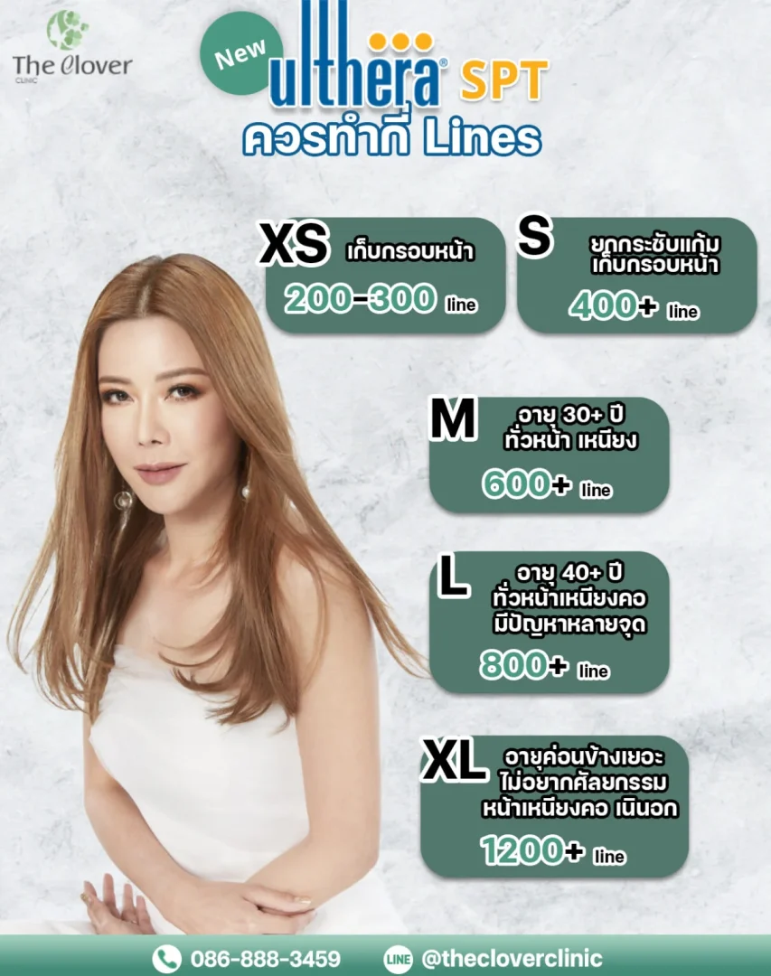 ulthera spt กี่ lines