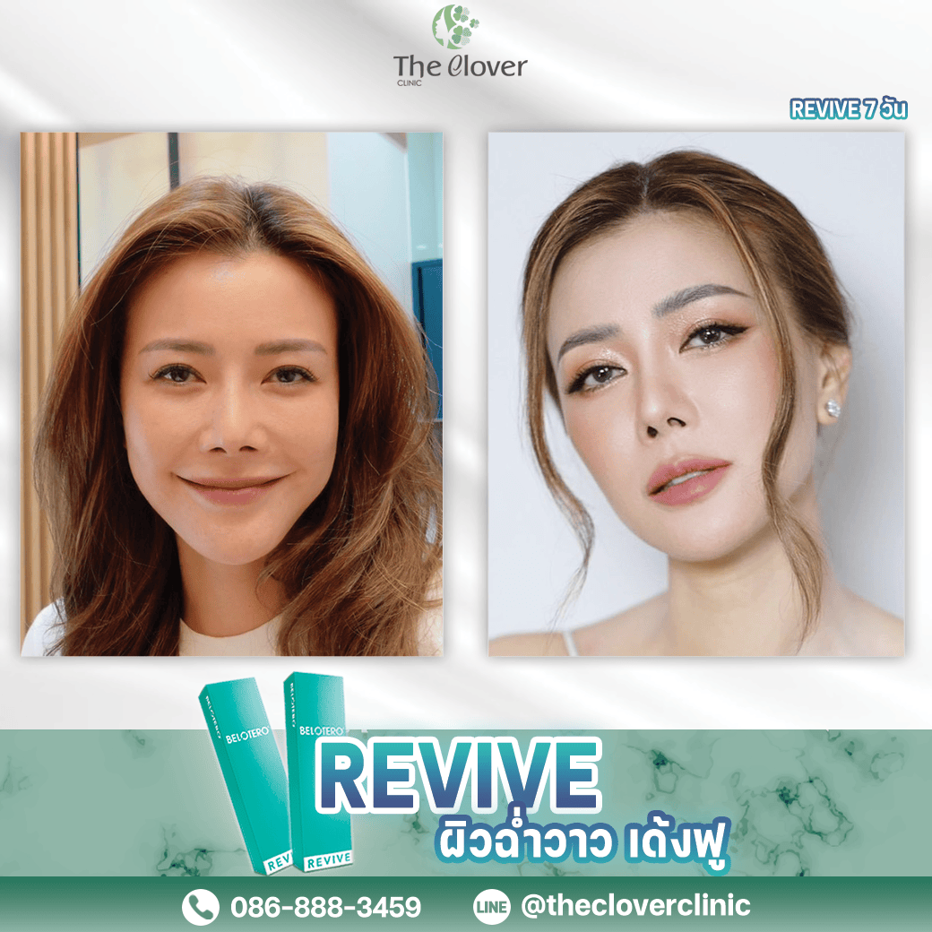 review revive