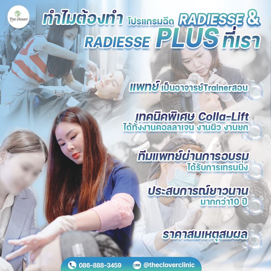 โปรแกรม ฉีดRadiesse