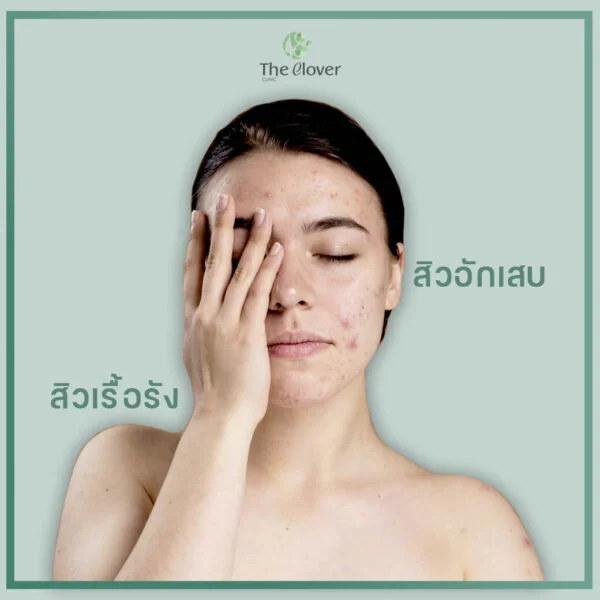 โปรแกรม C-Cell