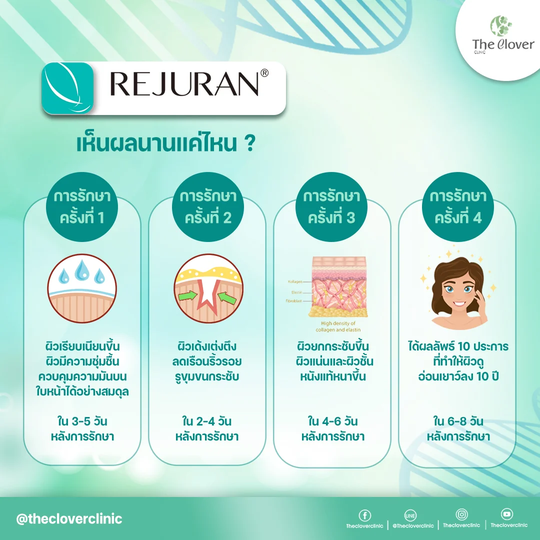 รีจูรัน (rejuran) ผิวยืดหยุ่น กระตุ้นการเกิดเซลล์ผิวใหม่