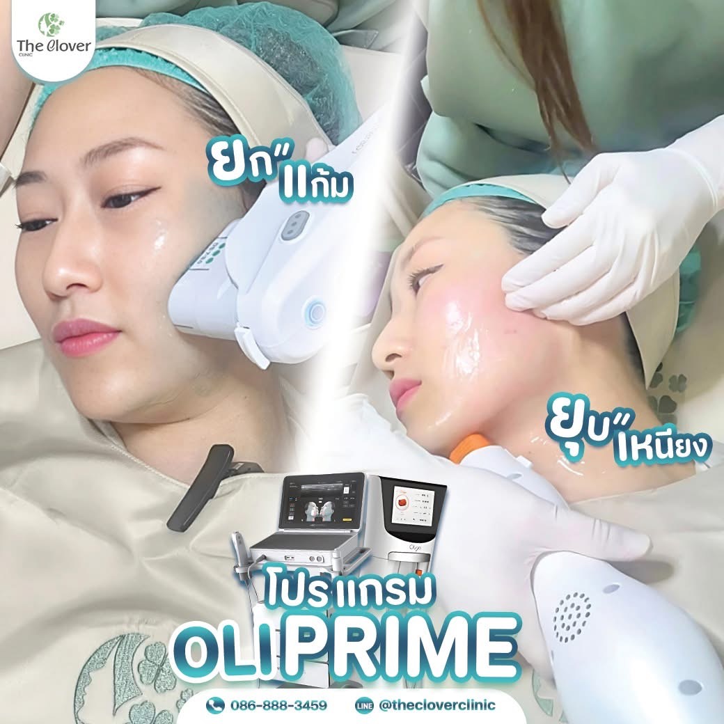 โปรแกรม OLIPRIM