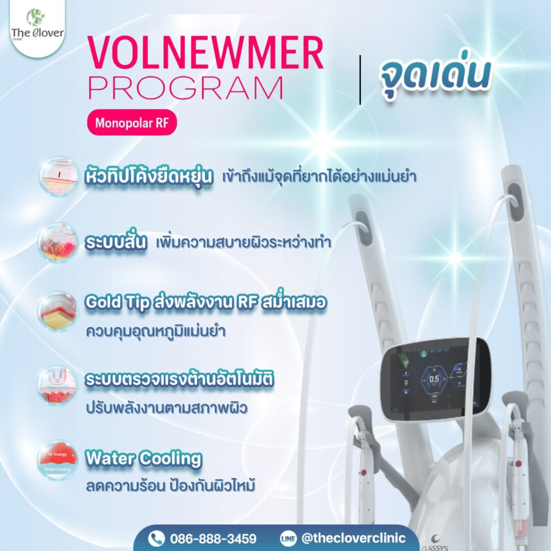 volnewmer จุดเด่น