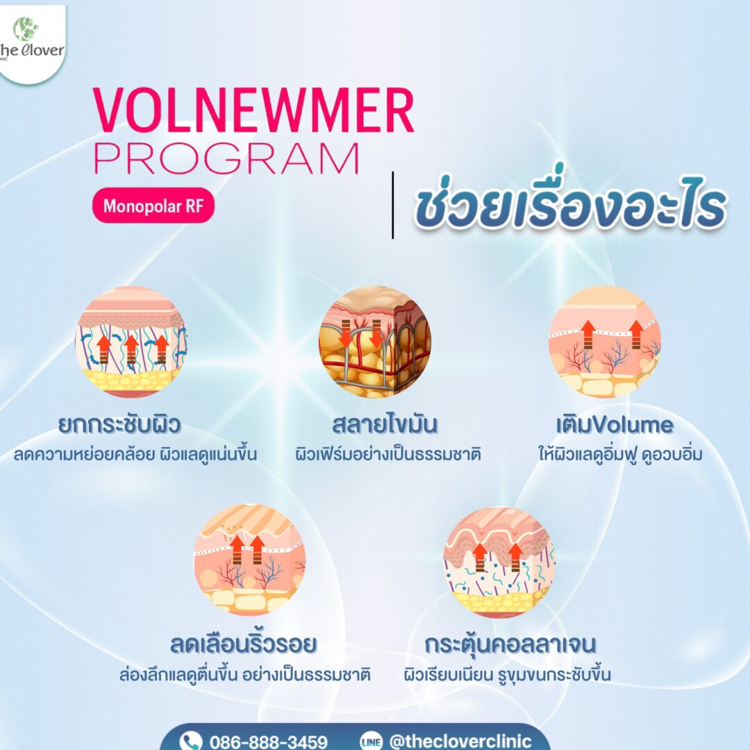 volnewmer ช่วยเรื่องอะไร