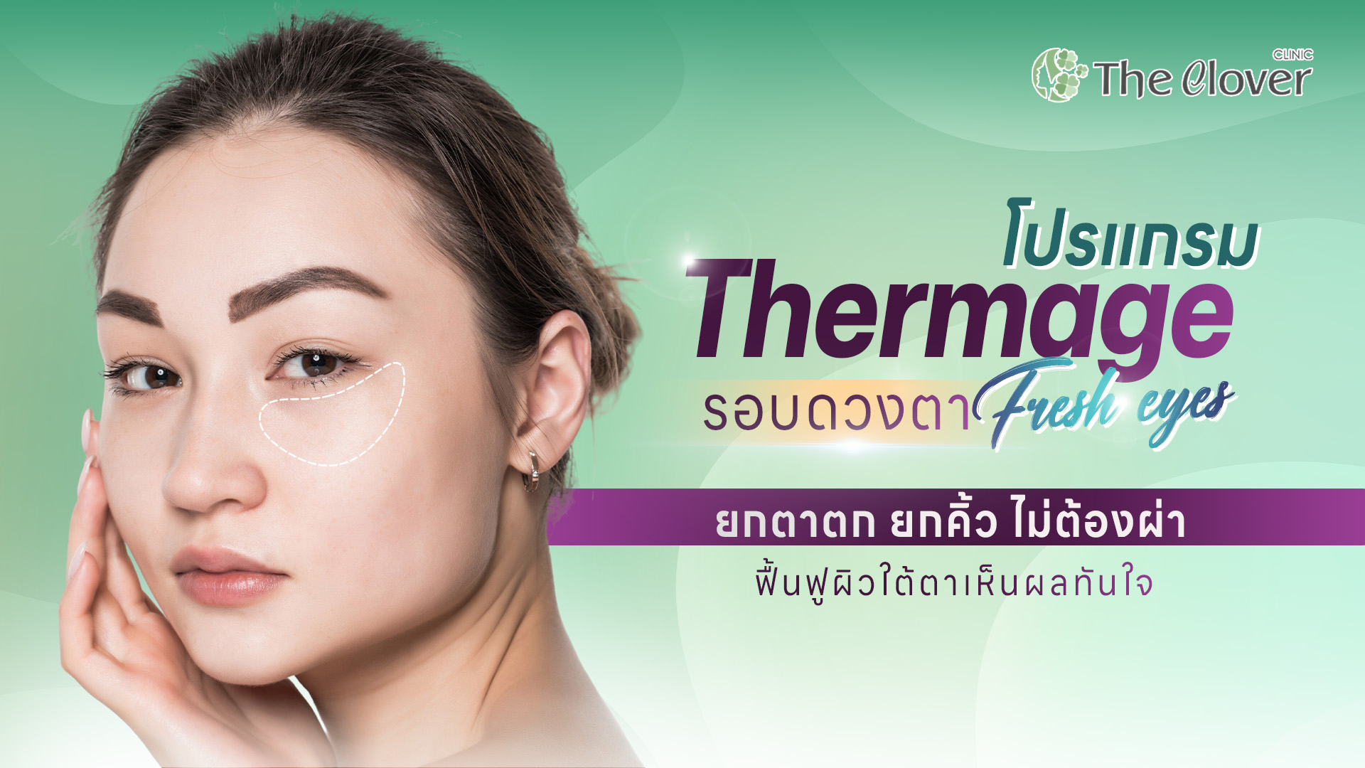 thermage ตา