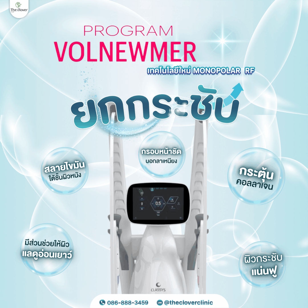 volnewmer