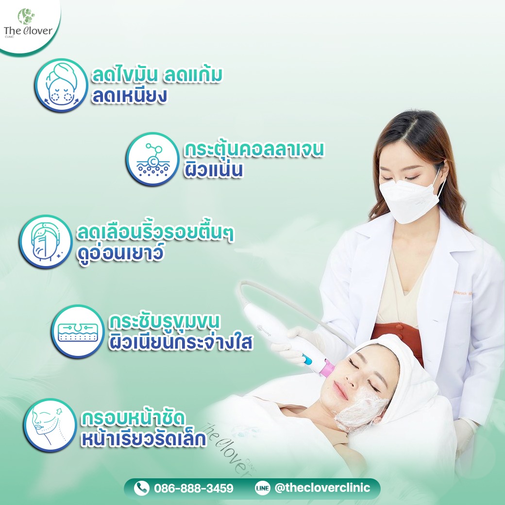 thermage flx the clover clinic