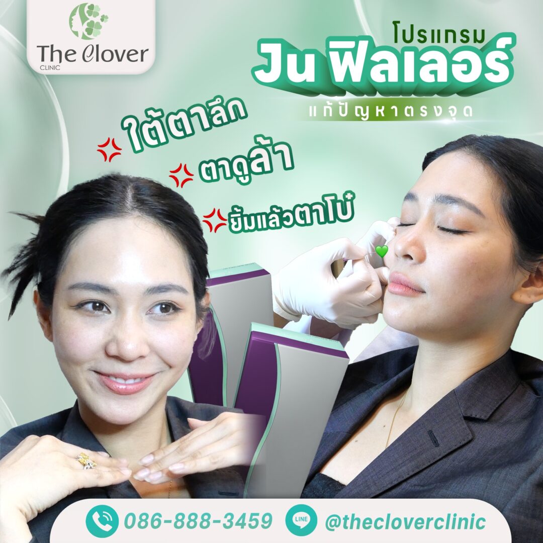 โปรแกรม JU ฟิลเลอร์