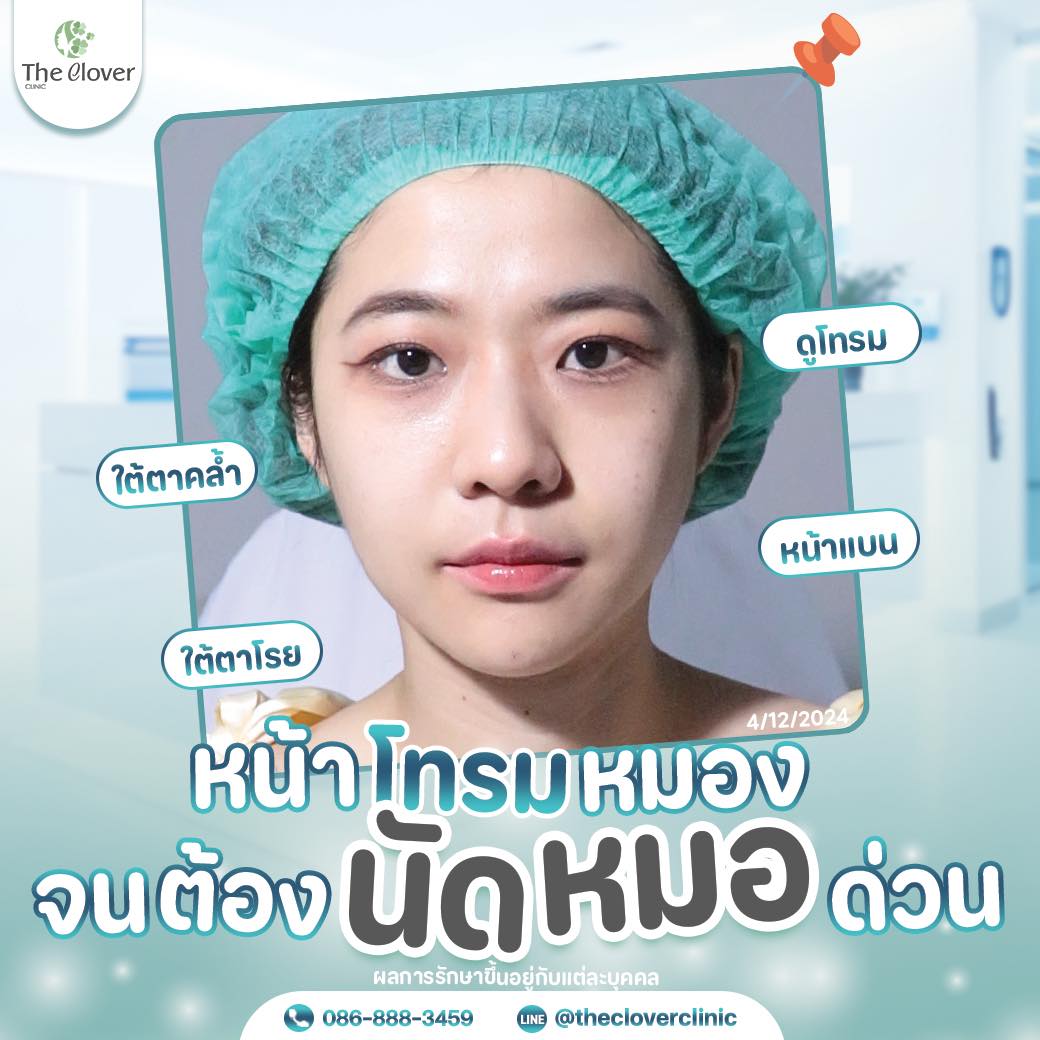 โปรแกรมฟิลเลอร์