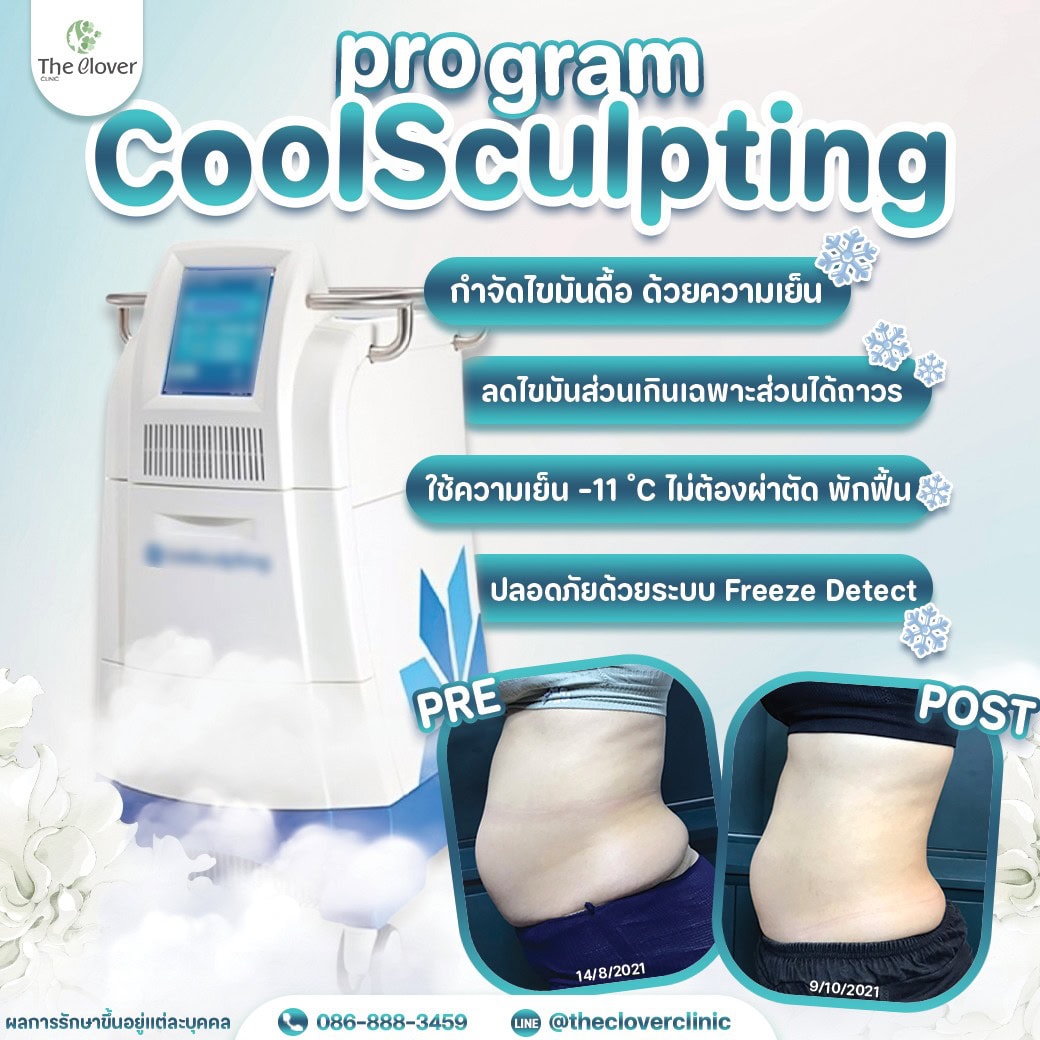 coolscupting - The Clover Clinic coolscupting
