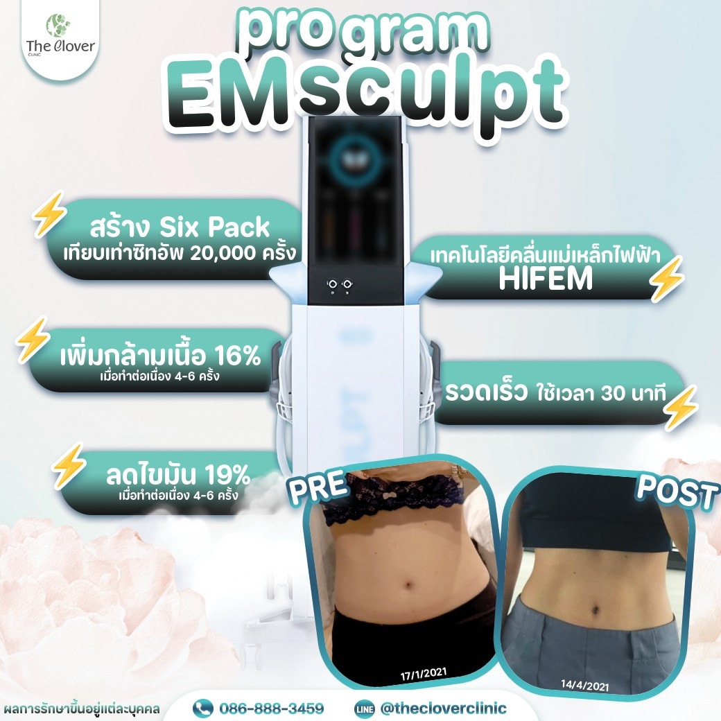 emsculpt - The Clover Clinic emsculpt