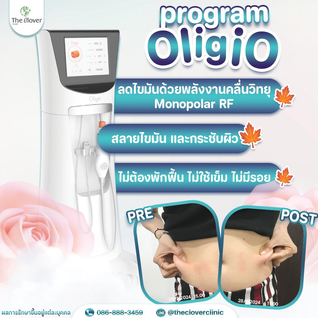 oligio - The Clover Clinic oligio