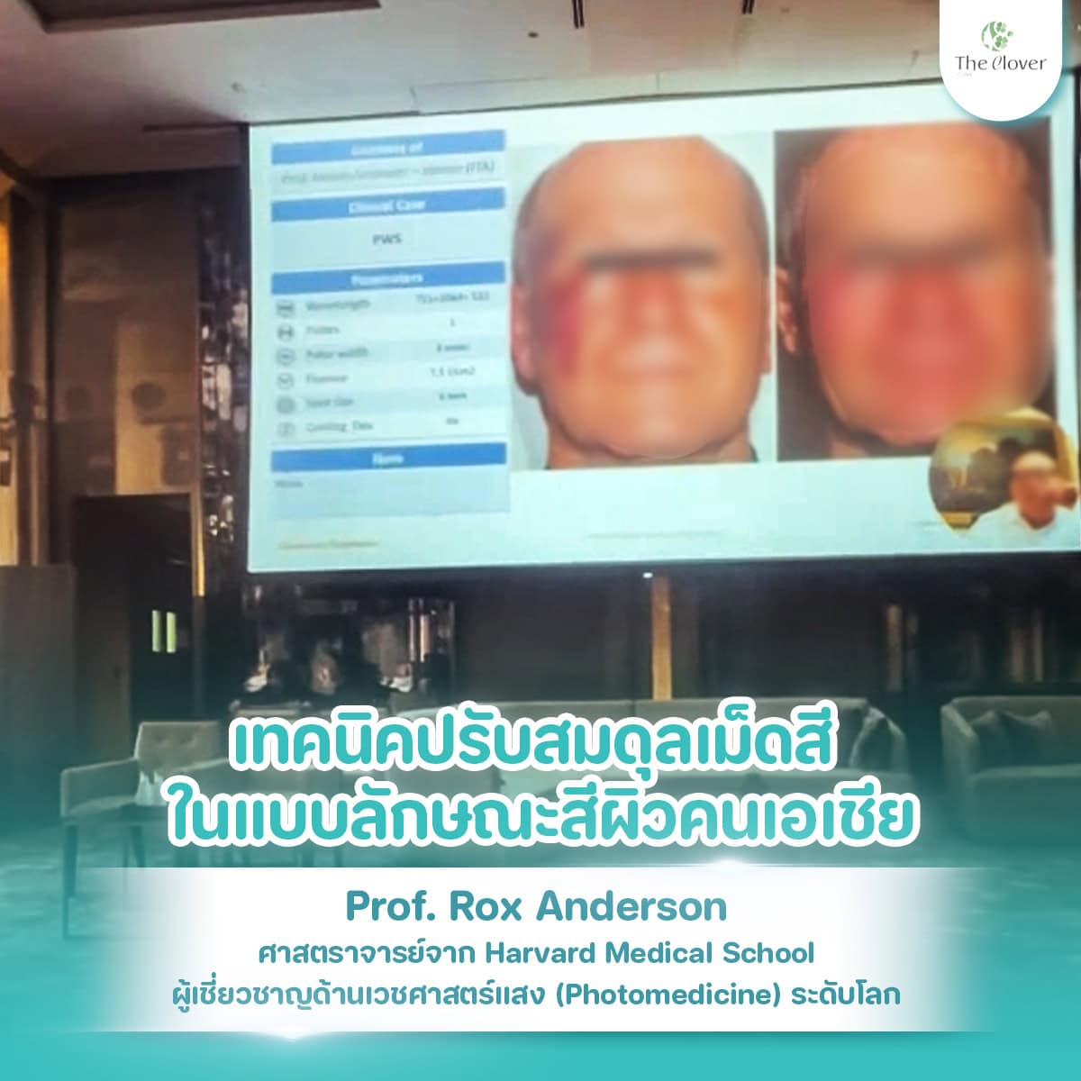 discovery pico 3 - The Clover Clinic discovery pico