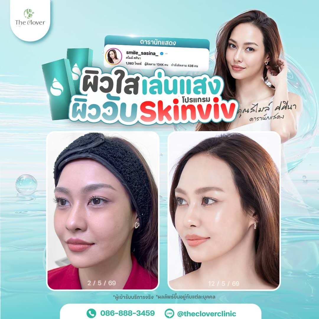skinviv - The Clover Clinic skinviv