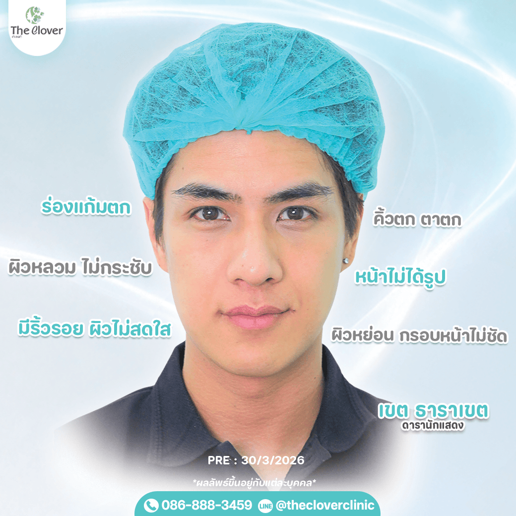 ket-prime-4 - The Clover Clinic เขต ธาราเขต ulthera